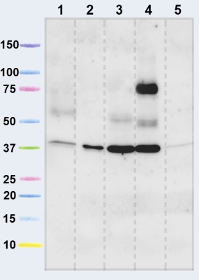 Western blot - Anti-VDAC1/Porin + VDAC3 antibody [20B12AF2] - Mitochondrial Loading Control (ab14734), expandable thumbnail