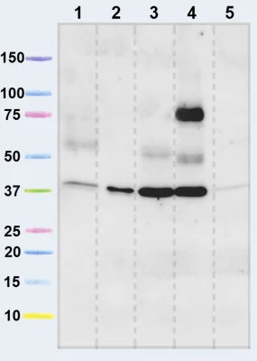 Western blot - Anti-VDAC1/Porin + VDAC3 antibody [20B12AF2] - Mitochondrial Loading Control (AB14734)