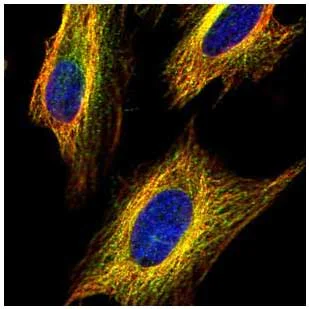 Immunocytochemistry/ Immunofluorescence - Anti-VDAC2 antibody - C-terminal - Mitochondrial Loading Control (AB155803)
