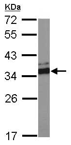 Western blot - Anti-VDAC2 antibody - C-terminal - Mitochondrial Loading Control (AB155803), expandable thumbnail