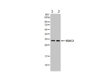 Western blot - Anti-VDAC2 antibody - C-terminal - Mitochondrial Loading Control (AB155803)