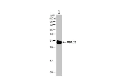Western blot - Anti-VDAC2 antibody - C-terminal - Mitochondrial Loading Control (AB155803)