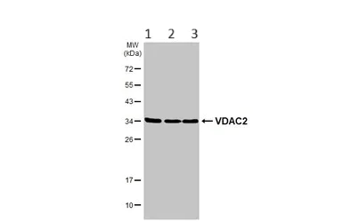 Western blot - Anti-VDAC2 antibody - C-terminal - Mitochondrial Loading Control (AB155803)