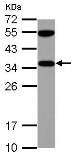 Western blot - Anti-VDAC2 antibody - C-terminal - Mitochondrial Loading Control (AB155803), expandable thumbnail