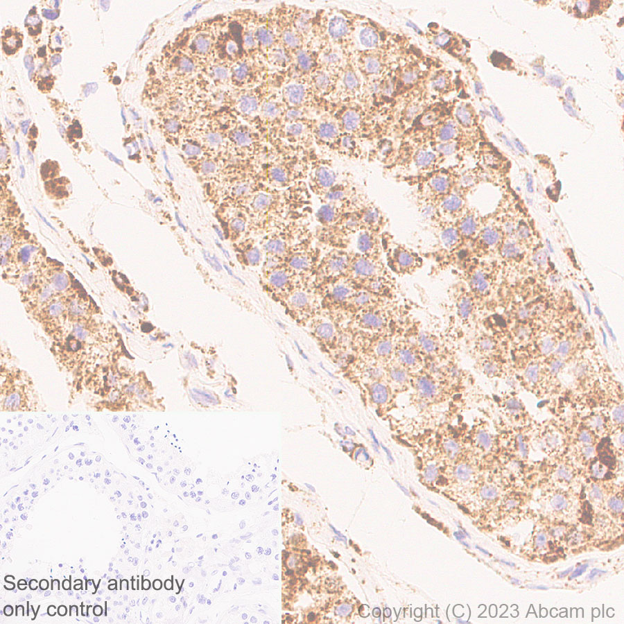 Immunohistochemistry (Formalin/PFA-fixed paraffin-embedded sections) - Anti-VDAC2 antibody [EPR27028-135] (ab316107), expandable thumbnail