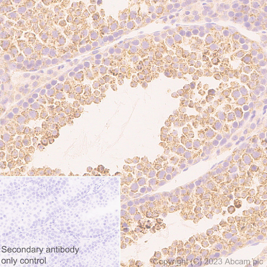 Immunohistochemistry (Formalin/PFA-fixed paraffin-embedded sections) - Anti-VDAC2 antibody [EPR27028-135] (ab316107), expandable thumbnail