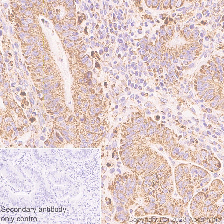 Immunohistochemistry (Formalin/PFA-fixed paraffin-embedded sections) - Anti-VDAC2 antibody [EPR27028-135] (ab316107), expandable thumbnail