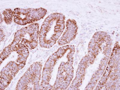 Immunohistochemistry (Formalin/PFA-fixed paraffin-embedded sections) - Anti-VDAC2 antibody (AB126120), expandable thumbnail