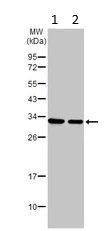 Western blot - Anti-VDAC2 antibody - Mitochondrial Loading Control (AB126120)