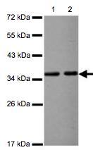 Western blot - Anti-VDAC2 antibody - Mitochondrial Loading Control (AB126120), expandable thumbnail