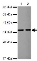 Western blot - Anti-VDAC2 antibody - Mitochondrial Loading Control (AB126120)