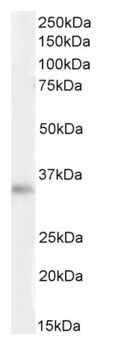 Western blot - Anti-VDAC2 antibody - Mitochondrial Loading Control (AB37985)