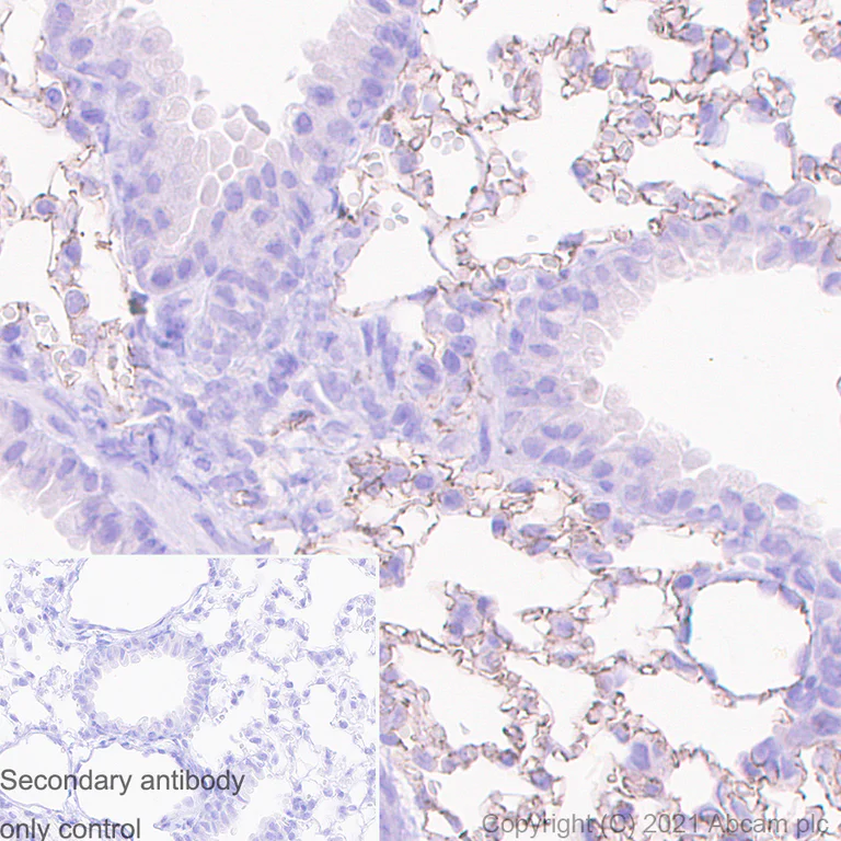 Immunohistochemistry (Formalin/PFA-fixed paraffin-embedded sections) - Anti-VE Cadherin antibody [11D4.1] - BSA and Azide free (AB282291)