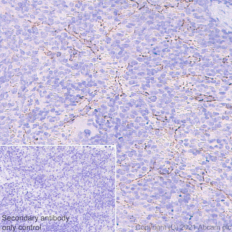 Immunohistochemistry (Formalin/PFA-fixed paraffin-embedded sections) - Anti-VE Cadherin antibody [11D4.1] - BSA and Azide free (AB282291)