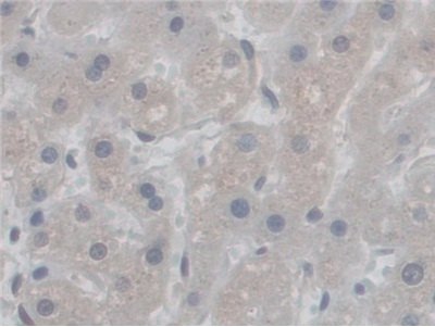 Immunohistochemistry (Formalin/PFA-fixed paraffin-embedded sections) - Anti-VE Cadherin antibody (AB232880)