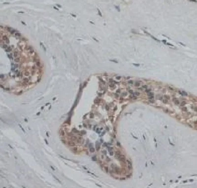 Immunohistochemistry (Formalin/PFA-fixed paraffin-embedded sections) - Anti-VE Cadherin antibody (AB232880)