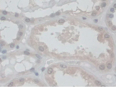Immunohistochemistry (Formalin/PFA-fixed paraffin-embedded sections) - Anti-VE Cadherin antibody (AB232880)