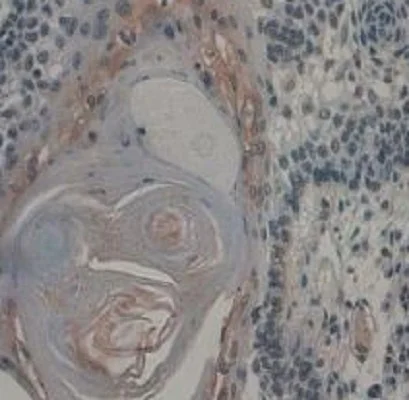 Immunohistochemistry (Formalin/PFA-fixed paraffin-embedded sections) - Anti-VE Cadherin antibody (AB232880)