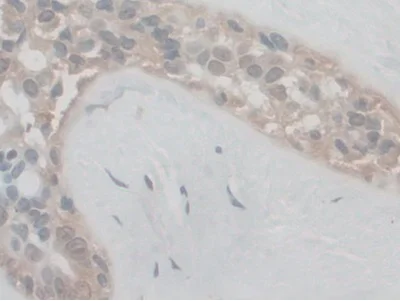 Immunohistochemistry (Formalin/PFA-fixed paraffin-embedded sections) - Anti-VE Cadherin antibody (AB232880)