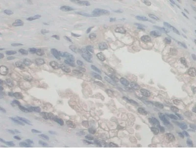 Immunohistochemistry (Formalin/PFA-fixed paraffin-embedded sections) - Anti-VE Cadherin antibody (AB232880)