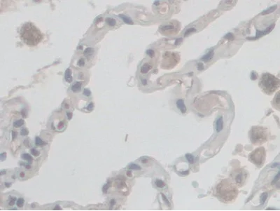 Immunohistochemistry (Formalin/PFA-fixed paraffin-embedded sections) - Anti-VE Cadherin antibody (AB232880)