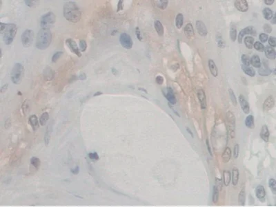 Immunohistochemistry (Formalin/PFA-fixed paraffin-embedded sections) - Anti-VE Cadherin antibody (AB232880)