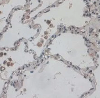 Immunohistochemistry (Formalin/PFA-fixed paraffin-embedded sections) - Anti-VE Cadherin antibody (AB232880)
