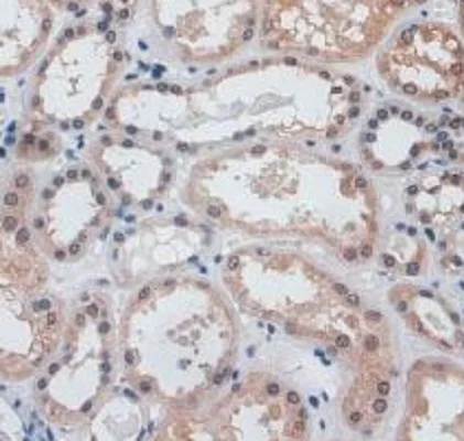 Immunohistochemistry (Formalin/PFA-fixed paraffin-embedded sections) - Anti-VE Cadherin antibody (AB232880)