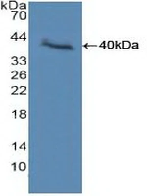 Western blot - Anti-VE Cadherin antibody (AB232880)