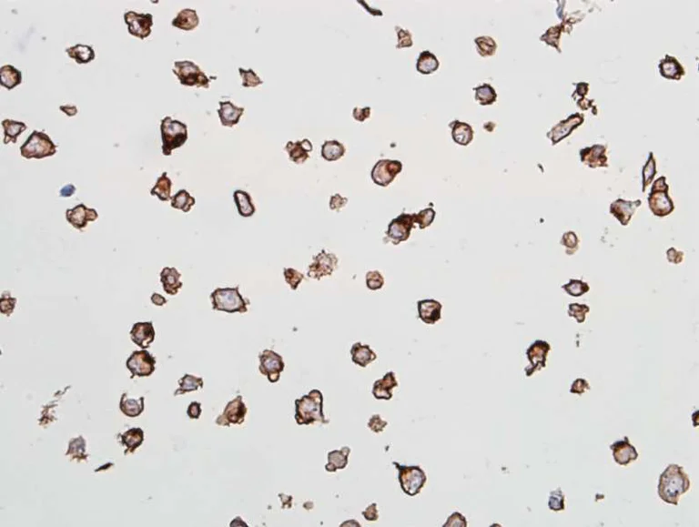 Immunocytochemistry - Anti-VE-Cadherin antibody [BLR091G] - BSA free (AB314094)