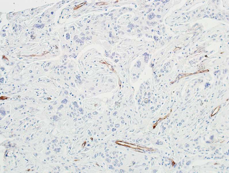 Immunohistochemistry (Formalin/PFA-fixed paraffin-embedded sections) - Anti-VE-Cadherin antibody [BLR091G] - BSA free (AB314094), expandable thumbnail