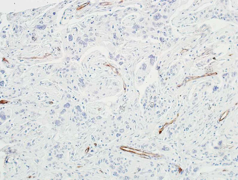 Immunohistochemistry (Formalin/PFA-fixed paraffin-embedded sections) - Anti-VE-Cadherin antibody [BLR091G] - BSA free (AB314094)