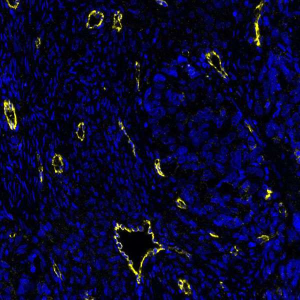 Immunohistochemistry (Formalin/PFA-fixed paraffin-embedded sections) - Anti-VE-Cadherin antibody [BLR091G] - BSA free (AB314094), expandable thumbnail