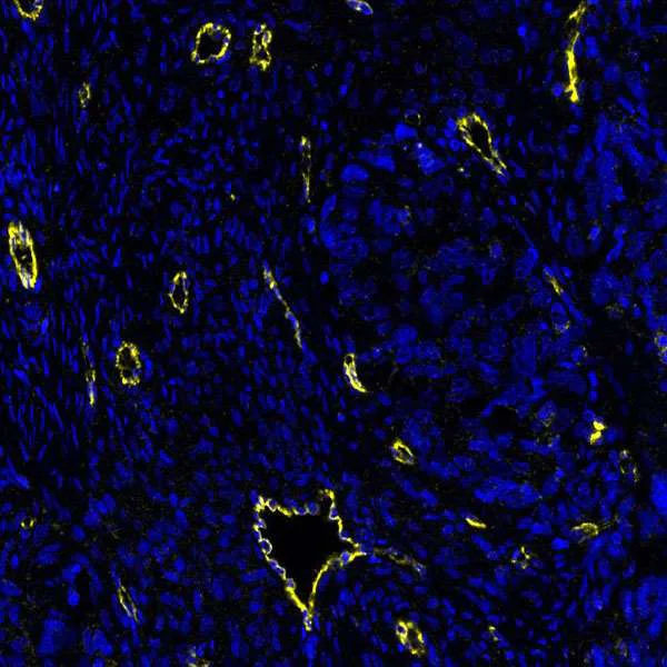 Immunohistochemistry (Formalin/PFA-fixed paraffin-embedded sections) - Anti-VE-Cadherin antibody [BLR091G] - BSA free (AB314094)