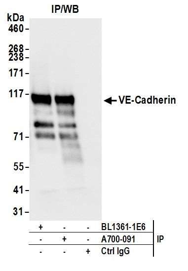 Immunoprecipitation - Anti-VE-Cadherin antibody [BLR091G] - BSA free (AB314094), expandable thumbnail