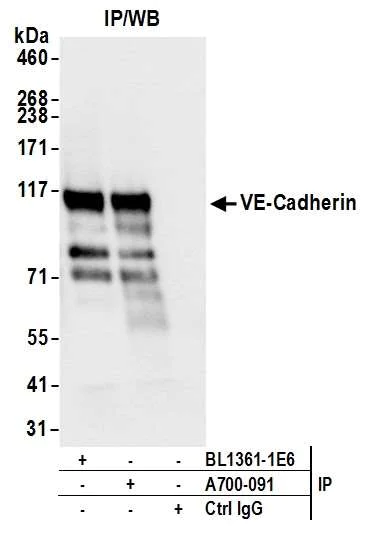 Immunoprecipitation - Anti-VE-Cadherin antibody [BLR091G] - BSA free (AB314094)