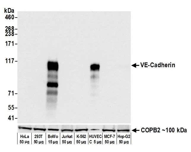Western blot - Anti-VE-Cadherin antibody [BLR091G] - BSA free (AB314094)