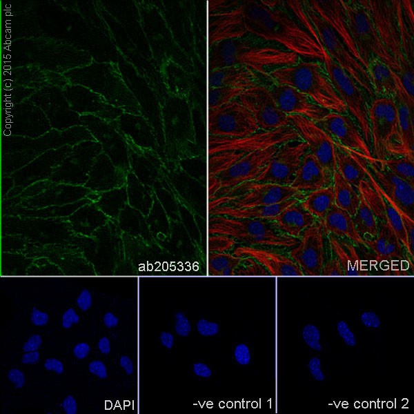 Immunocytochemistry/ Immunofluorescence - Anti-VE Cadherin antibody [EPR18229] - Intercellular Junction Marker (AB205336), expandable thumbnail