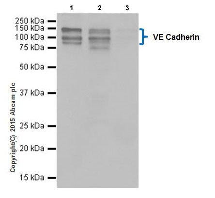Immunoprecipitation - Anti-VE Cadherin antibody [EPR18229] - Intercellular Junction Marker (AB205336), expandable thumbnail