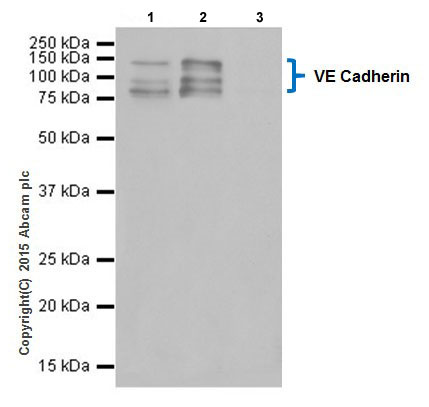 Immunoprecipitation - Anti-VE Cadherin antibody [EPR18229] - Intercellular Junction Marker (AB205336), expandable thumbnail
