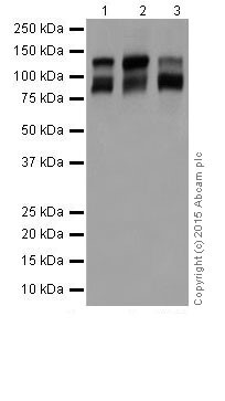 Western blot - Anti-VE Cadherin antibody [EPR18229] - Intercellular Junction Marker (AB205336), expandable thumbnail