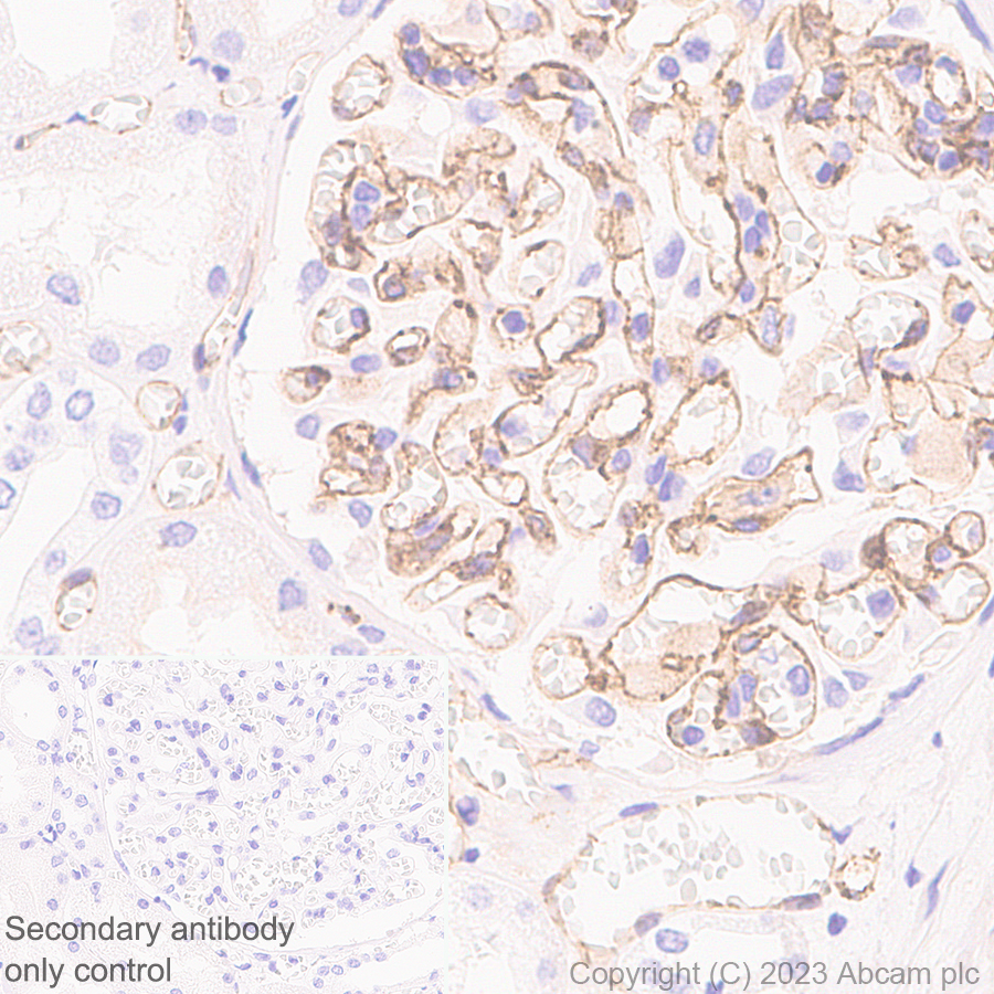 Immunohistochemistry (Formalin/PFA-fixed paraffin-embedded sections) - Anti-VE Cadherin antibody [EPR27436-55] (AB313632), expandable thumbnail