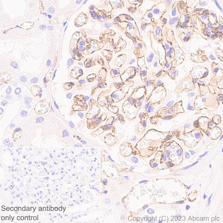 Immunohistochemistry (Formalin/PFA-fixed paraffin-embedded sections) - Anti-VE Cadherin antibody [EPR27436-55] (AB313632)