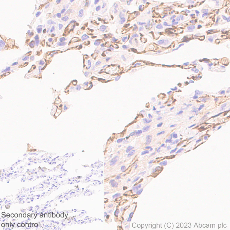Immunohistochemistry (Formalin/PFA-fixed paraffin-embedded sections) - Anti-VE Cadherin antibody [EPR27436-55] - BSA and Azide free (AB313633)