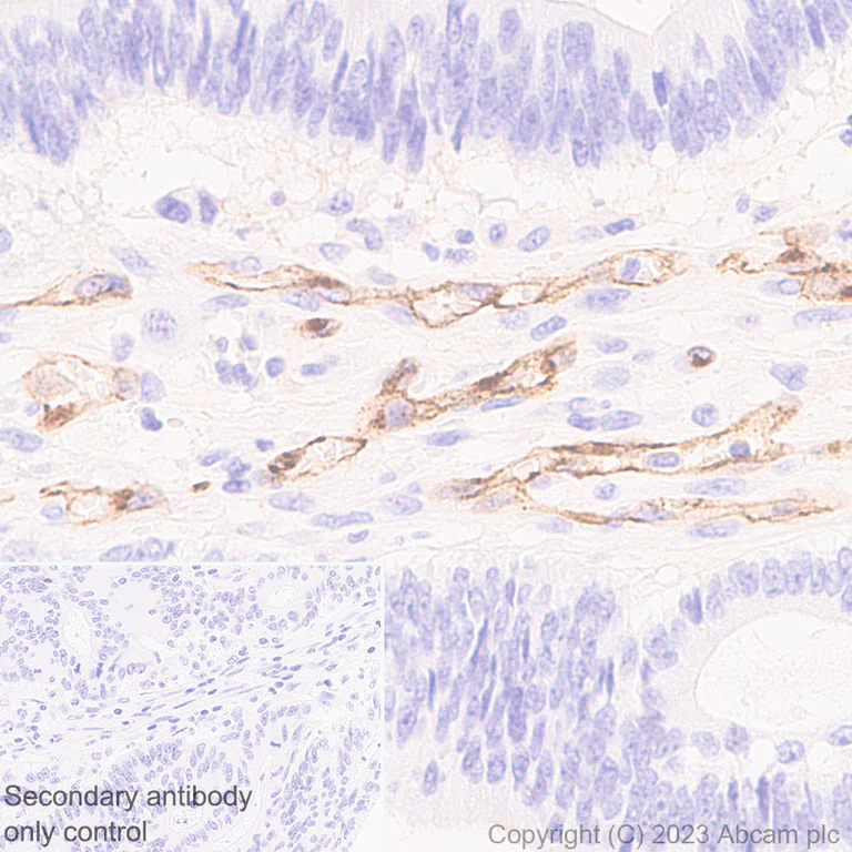 Immunohistochemistry (Formalin/PFA-fixed paraffin-embedded sections) - Anti-VE Cadherin antibody [EPR27436-55] - BSA and Azide free (AB313633)