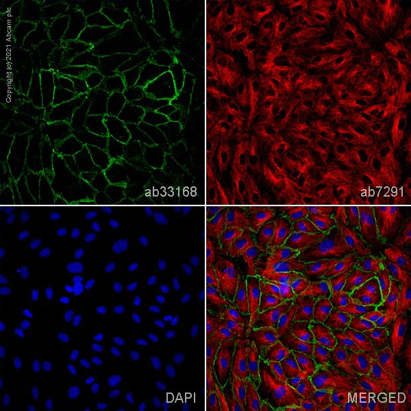 Immunocytochemistry/ Immunofluorescence - Anti-VE Cadherin antibody - Intercellular Junction Marker (AB33168)