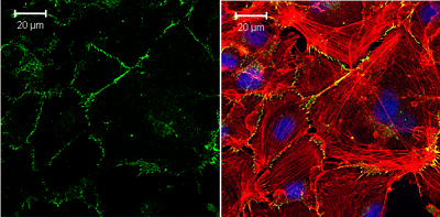 Immunocytochemistry/ Immunofluorescence - Anti-VE Cadherin antibody - Intercellular Junction Marker (AB33168), expandable thumbnail