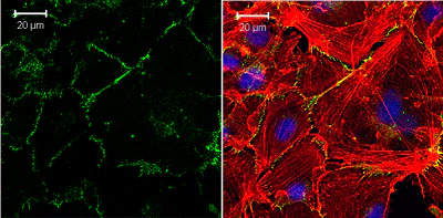 Immunocytochemistry/ Immunofluorescence - Anti-VE Cadherin antibody - Intercellular Junction Marker (AB33168)