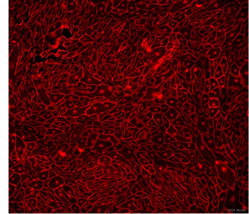 Immunocytochemistry/ Immunofluorescence - Anti-VE Cadherin antibody - Intercellular Junction Marker (ab33168), expandable thumbnail
