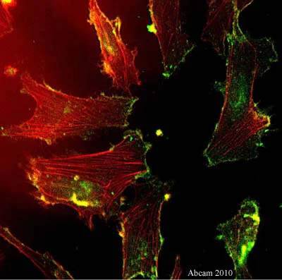 Immunocytochemistry/ Immunofluorescence - Anti-VE Cadherin antibody - Intercellular Junction Marker (AB33168)